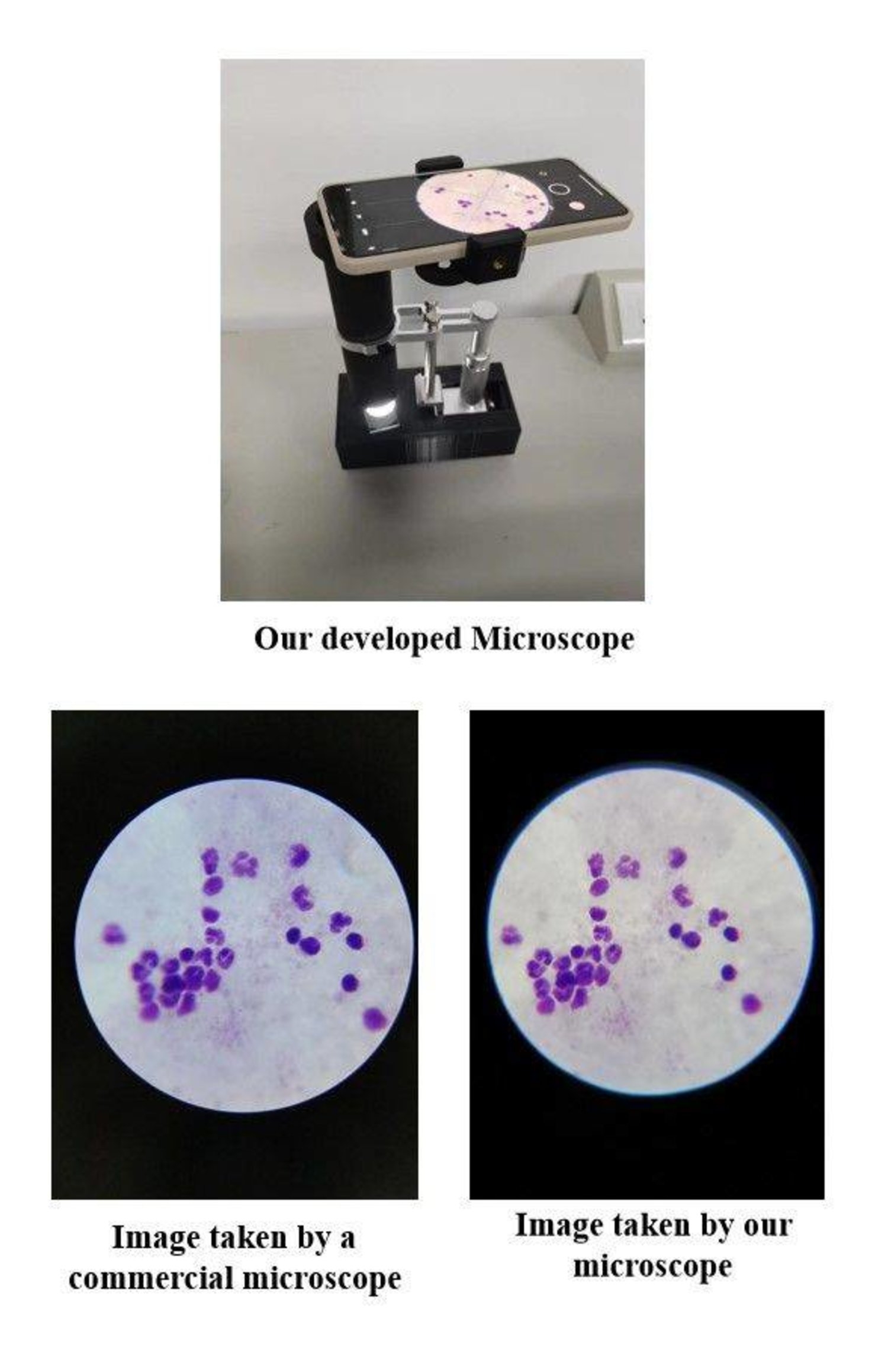 ثورة في تشخيص الملاريا باستخدام الذكاء الاصطناعي