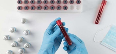 بە خۆراك كۆلیستیڕۆڵ دابەزێنە