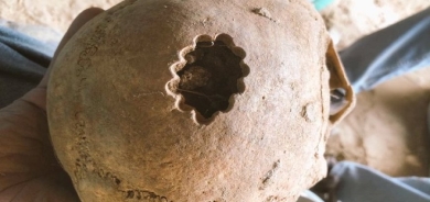 Li Wanê beriya 3 hezar salan emeliyata mêjî hatiye kirin