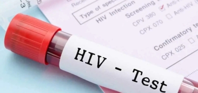 Li Herêma Kurdistanê 72 haletên nû yên pêketina bi HIV/AIDSê hatin tomarkirin