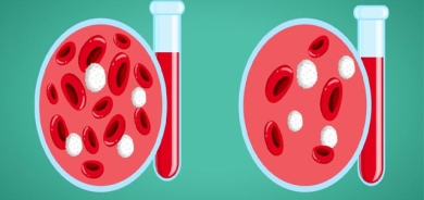 نیشانەكانی كەمخوێنی