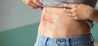 التطعيم المبكر ضد الهربس النطاقي يؤمِّن شيخوخة صحية