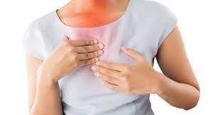 4 علامات تشير إلى إصابتك بالارتجاع الحمضي