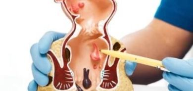 هل الجلوس بالمرحاض فترة طويلة يسبب البواسير؟ طبيب يجيب