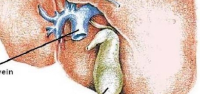 تعرّف على أسباب مرض الكبد الدهني وطرق علاجه؟