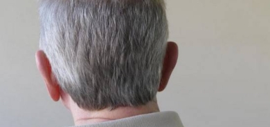 3 أسباب للشيب المبكر... تعرّف عليها وتجنّبها