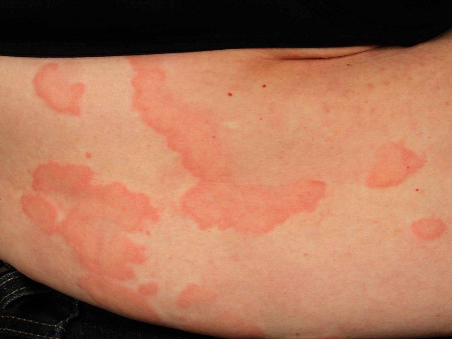 كيف تعرف أمراضك الخفية من خلال بشرتك؟!