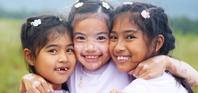 مرض البهاق وآثاره العضوية والنفسية على الأطفال