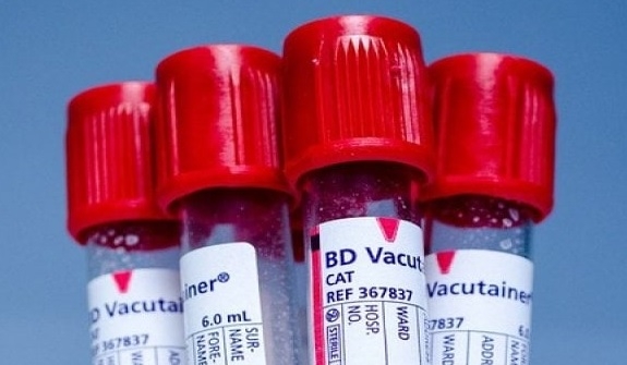 Baştirîn cureya xwînê hate diyarî kirin