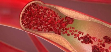 كيف تقوّي أوعيتك الدموية بسن الشيخوخة؟