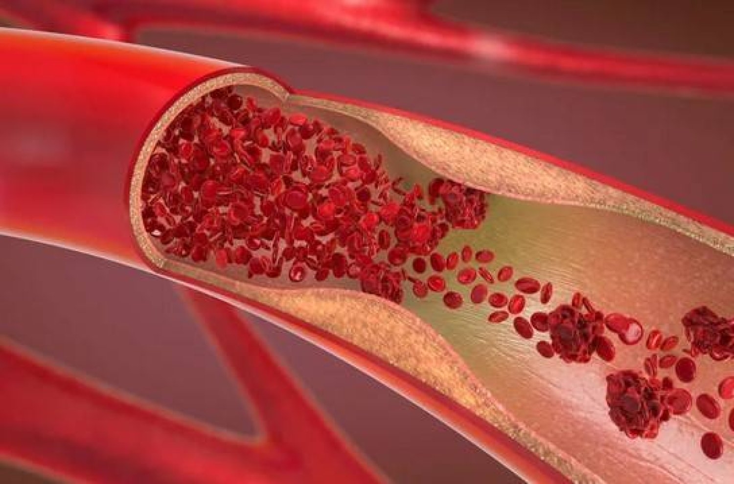 كيف تقوّي أوعيتك الدموية بسن الشيخوخة؟