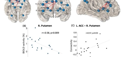 ڕۆڵی خەو لە تەندروستی مێشكدا