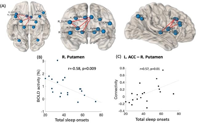 ڕۆڵی خەو لە تەندروستی مێشكدا