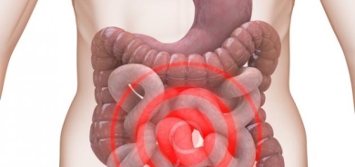 5 نصائح لتقليل خطر الإصابة بمتلازمة القولون العصبي