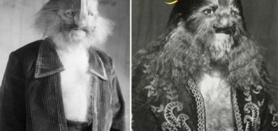 جەستەیەكی سەراپای لە موو