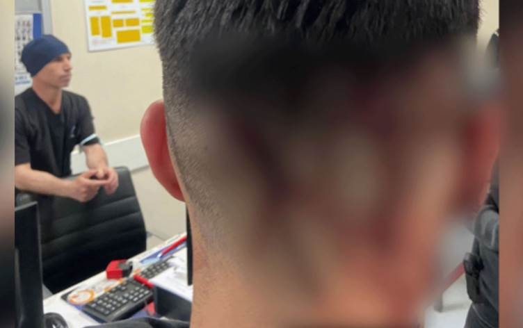 Li Amedê polîsan şkence li zarokekî kir: Parêzgariyê daxuyanî da