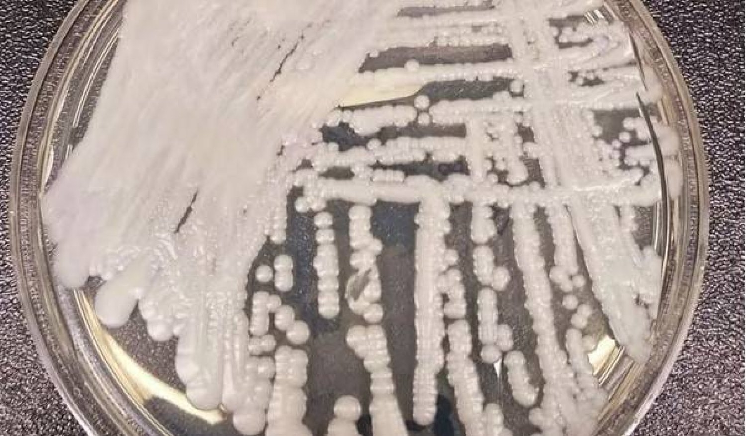 اكتشاف خميرة قد توقف الالتهابات الفطرية