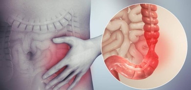 العلاج الغذائي «أكثر فاعلية» من أدوية «القولون العصبي»