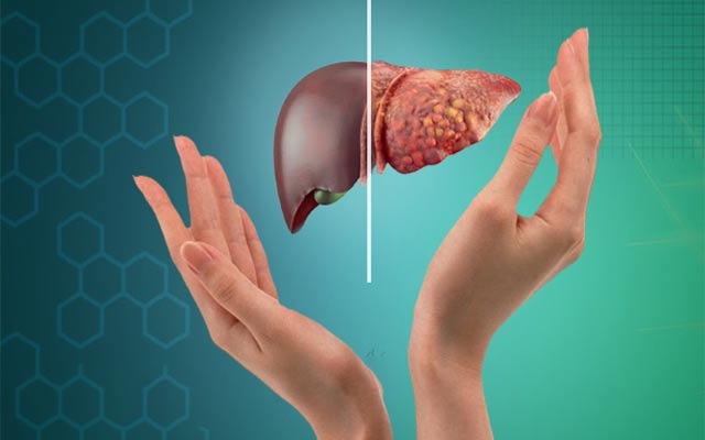 نیشانەكانی كۆبوونەوەی چەوری لە جگەردا