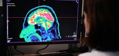 اكتشاف وظيفة غير متوقعة لـ