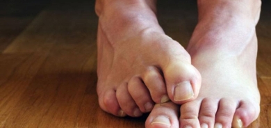 ماذا تخبر قدماك عن صحتك؟