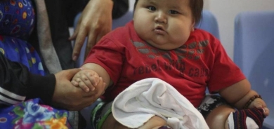 دراسة تحذر: سمنة الأطفال «تقصم» أعمارهم