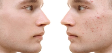 كل ما تريد معرفته عن 