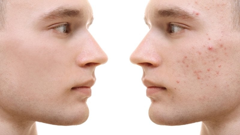 كل ما تريد معرفته عن 