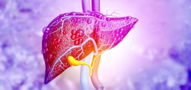 منها الارتباك والنسيان... 5 علامات تنذر بمشكلة في الكبد