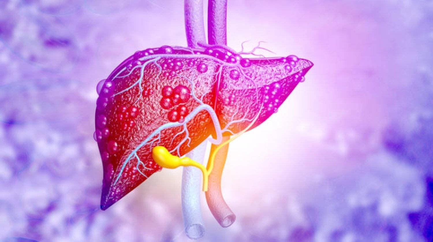 منها الارتباك والنسيان... 5 علامات تنذر بمشكلة في الكبد