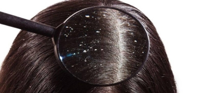 فروة الرأس وشمع الأذن وعمش العين... ماذا تقول عن صحتك؟