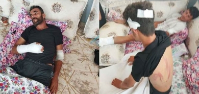 Li Muglayê nijadperestan êrişî 4 Kurdan kir, dest û lingên wan şikandin