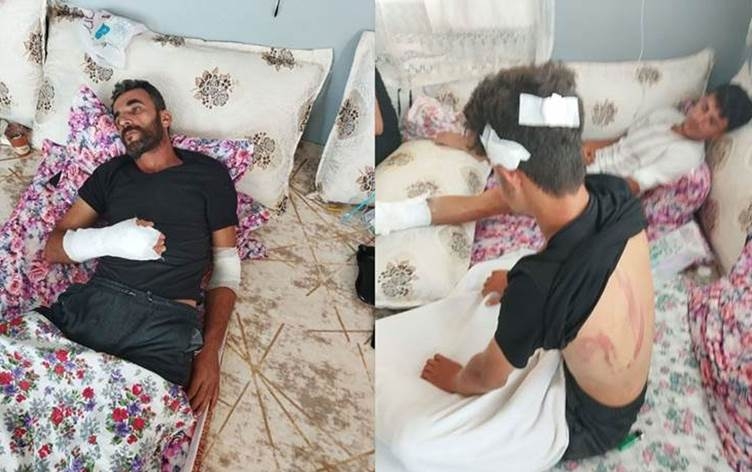 Li Muglayê nijadperestan êrişî 4 Kurdan kir, dest û lingên wan şikandin