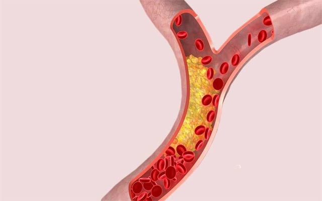 زانیاریی گرنگ سەبارەت بە كۆلیستڕۆڵ