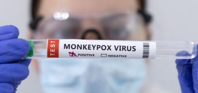 Kurdistan Region Ministry of Health Takes Proactive Steps to Prevent Monkeypox Spread