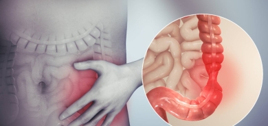 6 أطعمة تجعل قولونك العصبي في حالة «أسوأ»
