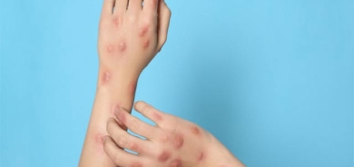 ئاوڵەی مەیموون چییە؟