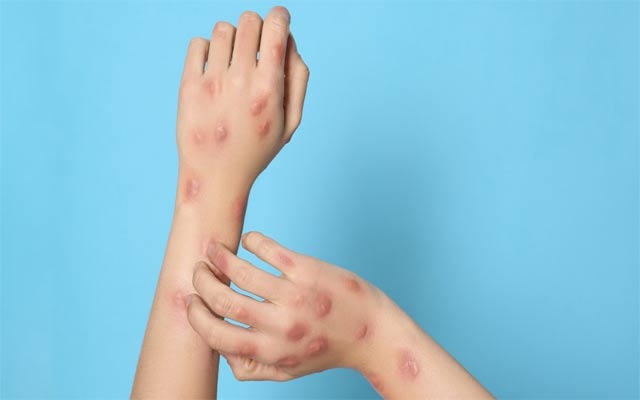 ئاوڵەی مەیموون چییە؟