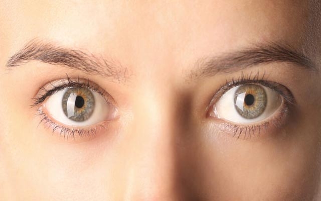 جەلتەی چاو چییە؟