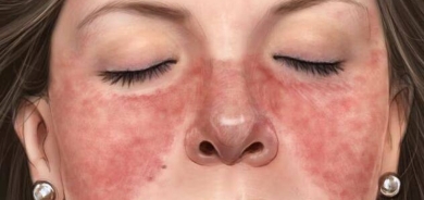 فكرة ألمانية «مجنونة» لعلاج أمراض المناعة الذاتية