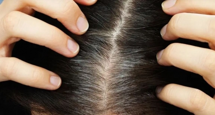 بالطريقة اليابانية.. أطعمة يمكن أن توقف شيب الشعر