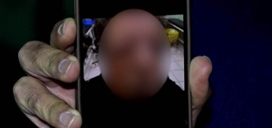 Her du çavên xwişka xwe derxistin