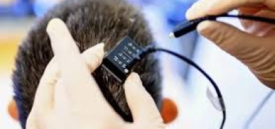 غرسة دماغية تترجم الأفكار إلى كلام مسموع بشكل فوري