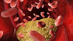 حقائق حول الكوليسترول... كيف تنقذون حياتكم؟