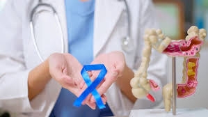 علامات بسيطة في جسدك قد تشير إلى إصابتك بسرطان الأمعاء