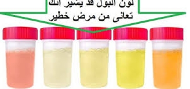 وردي أو أزرق أو عكر... ماذا يعكس لون البول عن حالتك الصحية؟