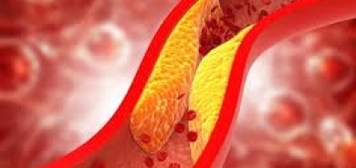 عندما يصبح الكوليسترول الجيد... ضارّاً