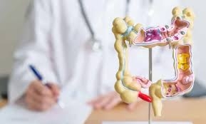 الارتفاع في سرطان القولون بين الشباب قد يكون مرتبطاً بالطفولة... ما العلاقة؟