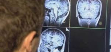 5 إجراءات للوقاية من الاكتئاب والخرف والسكتة الدماغية