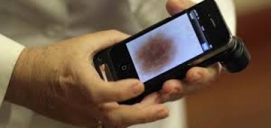 هواتف ذكية للكشف عن سرطان الجلد... كيف تعمل التقنية؟